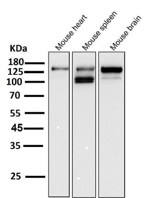 Anti-ASK1 MAP3K5 Rabbit Monoclonal Antibody Boster Bio