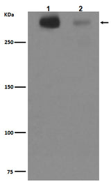 Anti-Tenascin C TNC Rabbit Monoclonal Antibody Boster Bio
