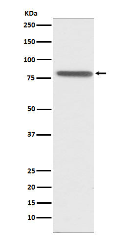 Anti-PSAP Rabbit Monoclonal Antibody Boster Bio