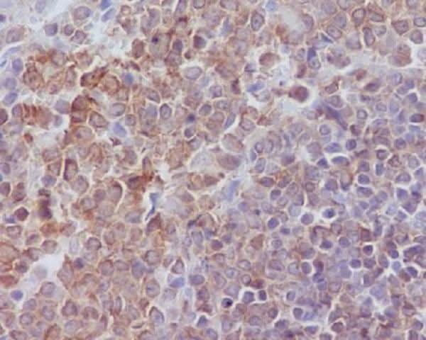 Anti-SHP1 PTPN6 Rabbit Monoclonal Antibody Boster Bio