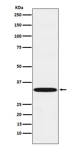 Anti-TREX1 Rabbit Monoclonal Antibody Boster Bio