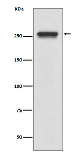 Anti-FASN/Fatty Acid Synthase Rabbit Monoclonal Antibody Boster Bio