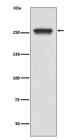 Anti-FASN/Fatty Acid Synthase Rabbit Monoclonal Antibody Boster Bio