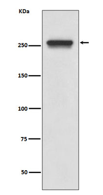 Anti-FASN/Fatty Acid Synthase Rabbit Monoclonal Antibody Boster Bio
