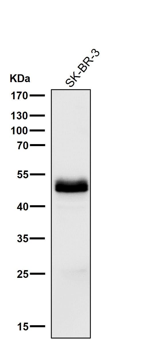 Anti-PAX8 Rabbit Monoclonal Antibody Boster Bio
