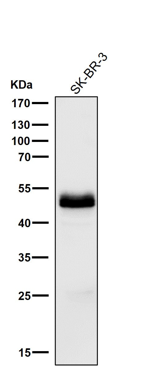 Anti-PAX8 Rabbit Monoclonal Antibody Boster Bio