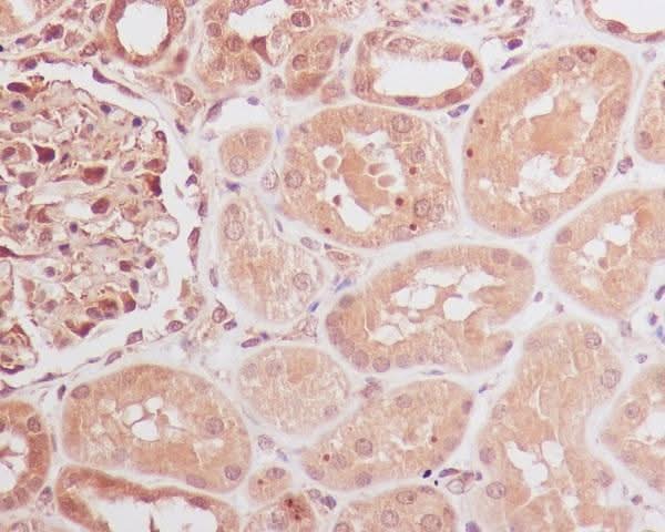 Anti-Id1 Rabbit Monoclonal Antibody Boster Bio