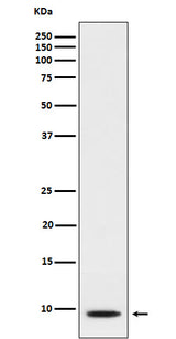 Anti-CXCL5 Rabbit Monoclonal Antibody Boster Bio