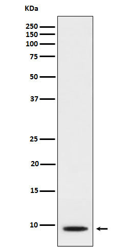 Anti-CXCL5 Rabbit Monoclonal Antibody Boster Bio