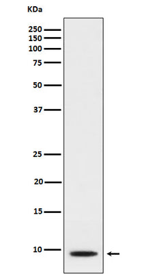 Anti-CXCL5 Rabbit Monoclonal Antibody Boster Bio