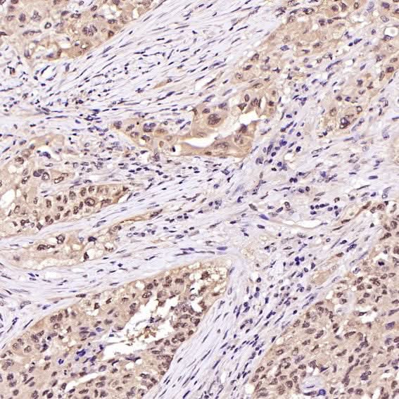 Anti-Hsp70 HSPA1A Rabbit Monoclonal Antibody Boster Bio