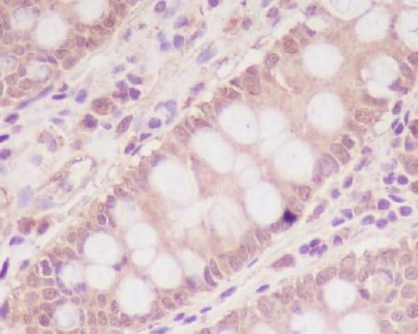 Anti-M6PR IGF2R Rabbit Monoclonal Antibody Boster Bio