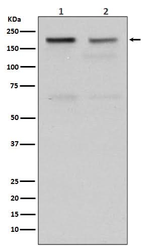 Anti-Topoisomerase II alpha TOP2A Rabbit Monoclonal Antibody Boster Bio