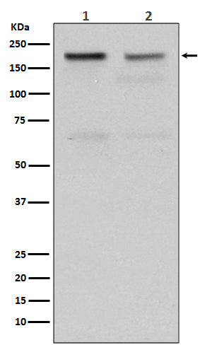 Anti-Topoisomerase II alpha TOP2A Rabbit Monoclonal Antibody Boster Bio