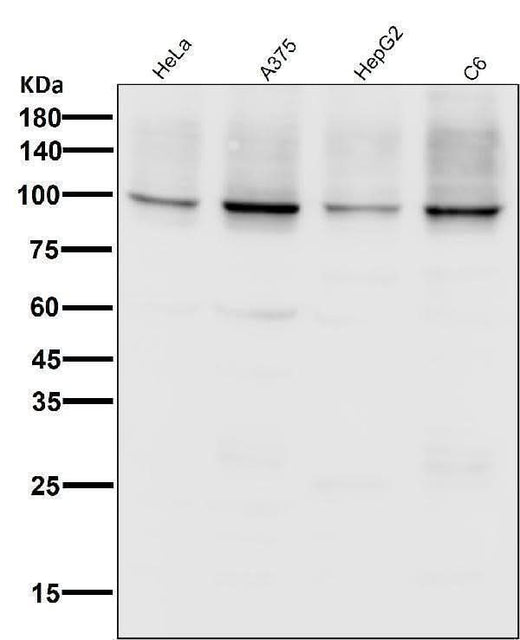 Anti-Sodium Potassium ATPase ATP1A1 Rabbit Monoclonal Antibody Boster Bio
