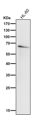 Anti-IRF5 Rabbit Monoclonal Antibody Boster Bio