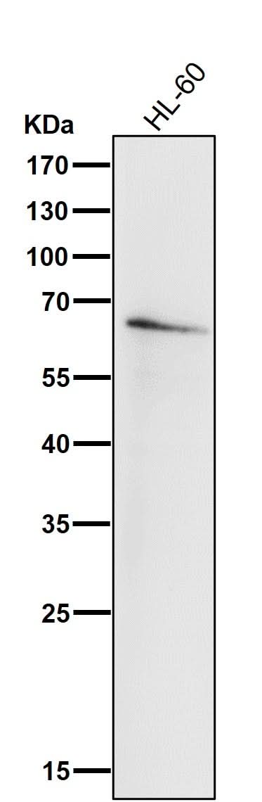 Anti-IRF5 Rabbit Monoclonal Antibody Boster Bio