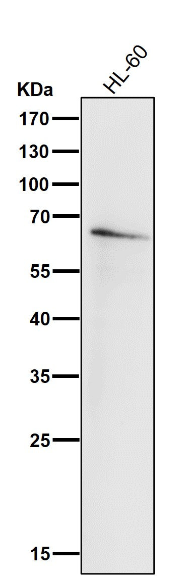 Anti-IRF5 Rabbit Monoclonal Antibody Boster Bio