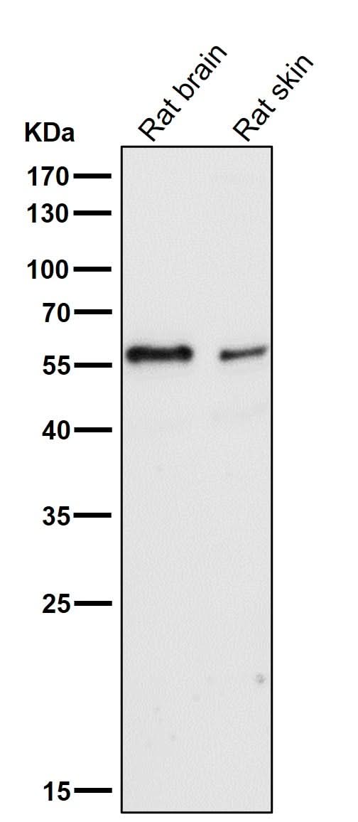 Anti-IRF5 Rabbit Monoclonal Antibody Boster Bio