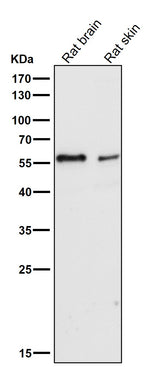 Anti-IRF5 Rabbit Monoclonal Antibody Boster Bio