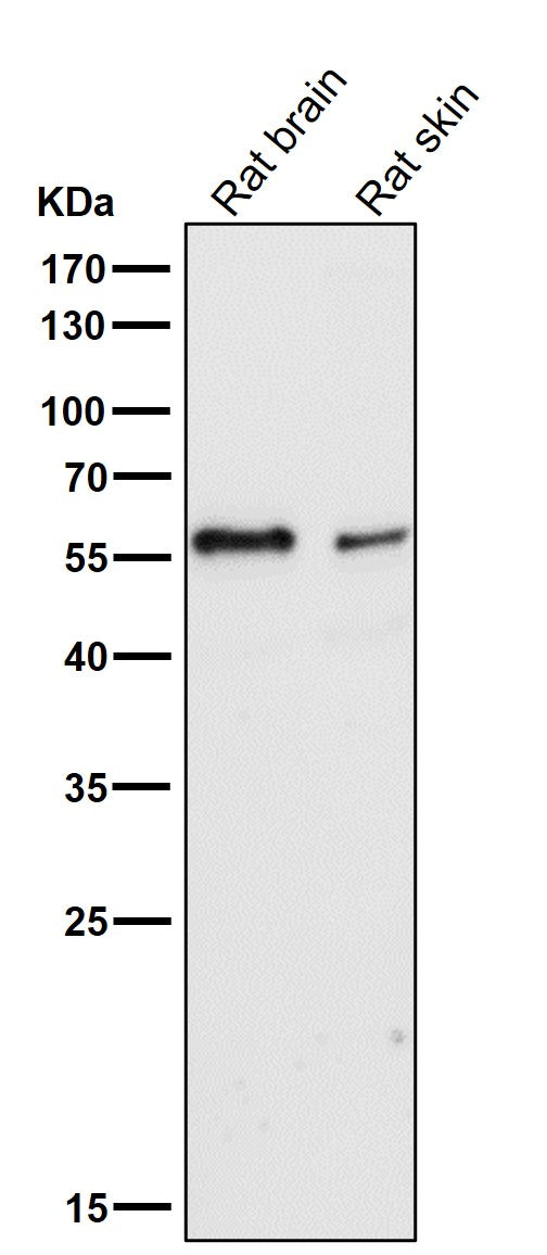 Anti-IRF5 Rabbit Monoclonal Antibody Boster Bio