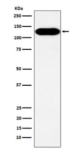 Anti-BCAR1 Rabbit Monoclonal Antibody Boster Bio