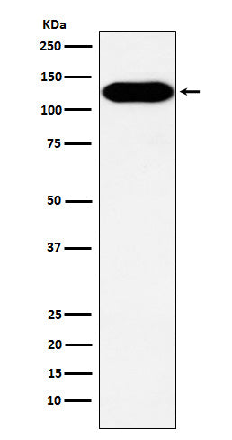 Anti-BCAR1 Rabbit Monoclonal Antibody Boster Bio