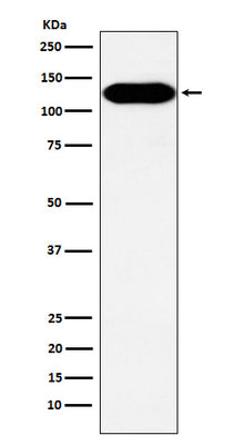 Anti-BCAR1 Rabbit Monoclonal Antibody Boster Bio