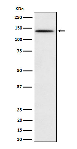 Anti-Phospho-BCAR1 (Y410) Rabbit Monoclonal Antibody Boster Bio