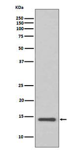 Anti-Cystatin C CST3 Rabbit Monoclonal Antibody Boster Bio