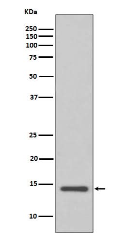Anti-Cystatin C CST3 Rabbit Monoclonal Antibody Boster Bio
