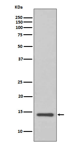 Anti-Cystatin C CST3 Rabbit Monoclonal Antibody Boster Bio