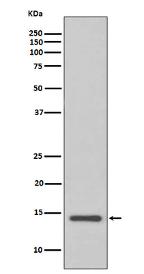 Anti-Cystatin C CST3 Rabbit Monoclonal Antibody Boster Bio
