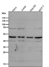 Anti-MyoD1/Myod Rabbit Monoclonal Antibody Boster Bio