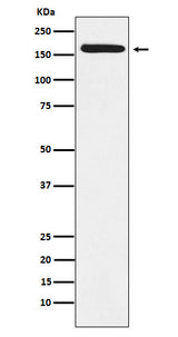 Anti-BAT3 Rabbit Monoclonal Antibody Boster Bio