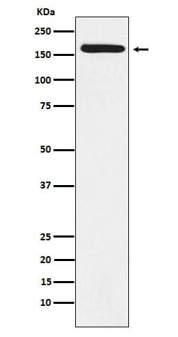 Anti-BAT3 Rabbit Monoclonal Antibody Boster Bio