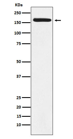 Anti-BAT3 Rabbit Monoclonal Antibody Boster Bio