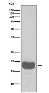 Anti-eIF4EBP1/4Ebp1 Rabbit Monoclonal Antibody Boster Bio
