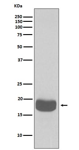 Anti-eIF4EBP1/4Ebp1 Rabbit Monoclonal Antibody Boster Bio