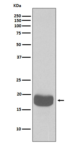 Anti-eIF4EBP1/4Ebp1 Rabbit Monoclonal Antibody Boster Bio