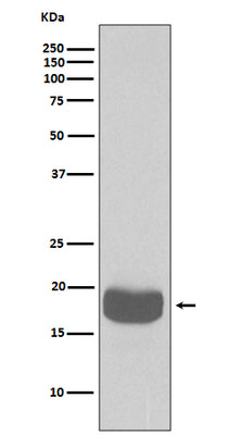 Anti-eIF4EBP1/4Ebp1 Rabbit Monoclonal Antibody Boster Bio