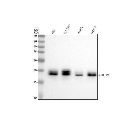 Anti-Phospho-eIF4EBP1/2/3 (T46+T46+T32) Rabbit Monoclonal Antibody Boster Bio