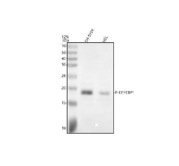 Anti-Phospho-eIF4EBP1 (T70) Rabbit Monoclonal Antibody Boster Bio