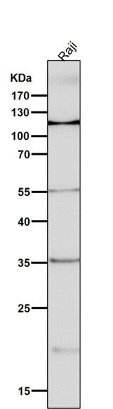 Anti-NFAT1 NFATC2 Rabbit Monoclonal Antibody Boster Bio