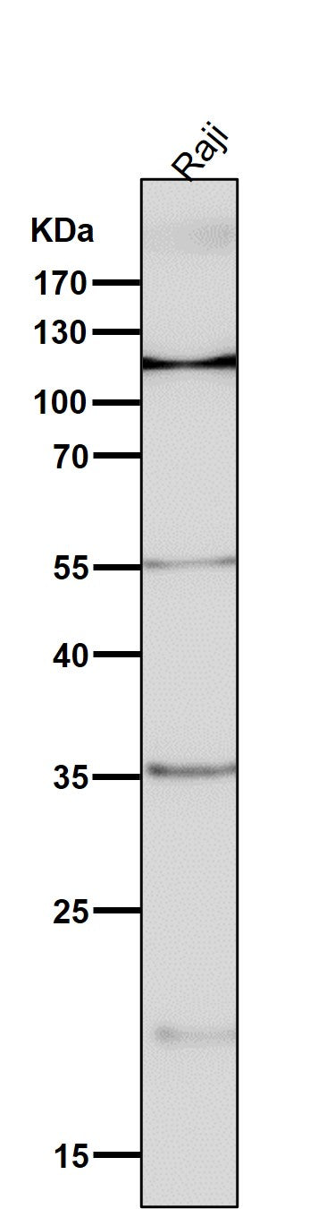 Anti-NFAT1 NFATC2 Rabbit Monoclonal Antibody Boster Bio