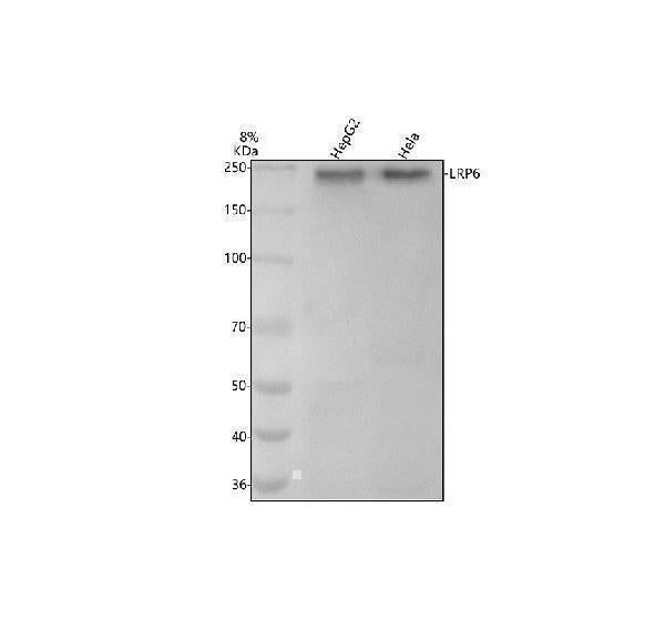 Anti-LRP6 Rabbit Monoclonal Antibody Boster Bio
