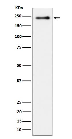 Anti-Phospho-LRP6 (S1490) Rabbit Monoclonal Antibody Boster Bio