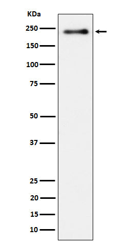 Anti-Phospho-LRP6 (S1490) Rabbit Monoclonal Antibody Boster Bio