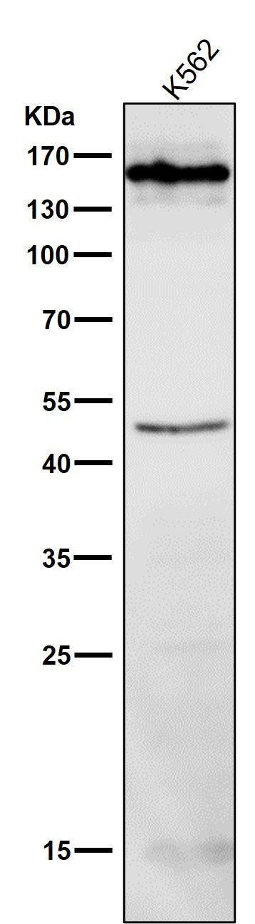 Anti-HDAC4/Histone Deacetylase 4 Rabbit Monoclonal Antibody Boster Bio