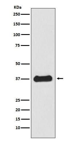 Anti-Follistatin Rabbit Monoclonal Antibody Boster Bio